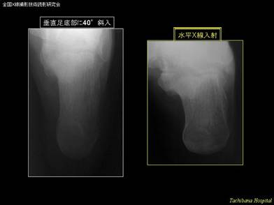 普及させたい撮影法：教科書や撮影技術本に掲載して欲しい撮影法