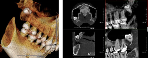 3D CTスキャン -アーム型X線CT診断装置- « 東海歯科医院 | 岡崎市で歯
