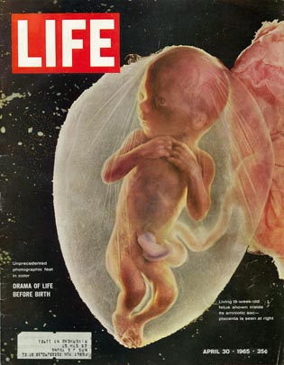 休八ノート - A Child Is Born