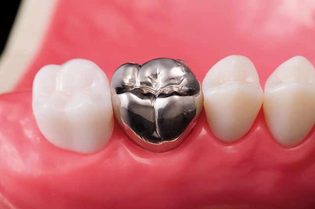 技工物 | Leo歯科クリニック