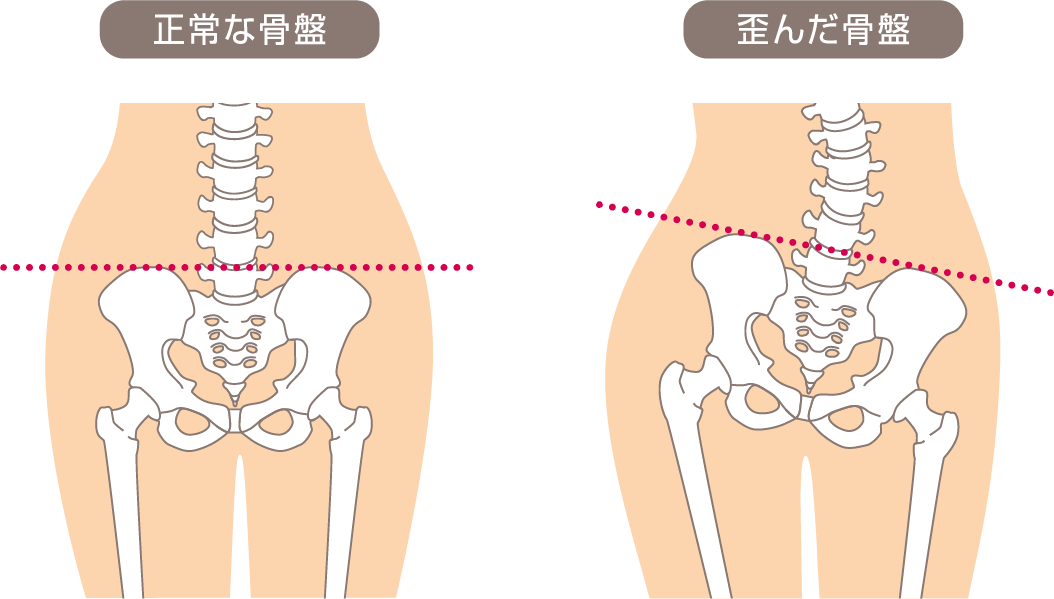 骨盤調整とは | はるな堂 | 長野県上田市の骨盤調整 | 腰痛・五十肩