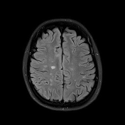 人間ドック 脳ドック・肺ドック｜磯部クリニック｜埼玉県深谷市