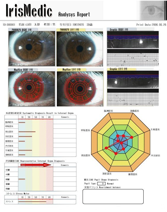 3.虹彩分析について