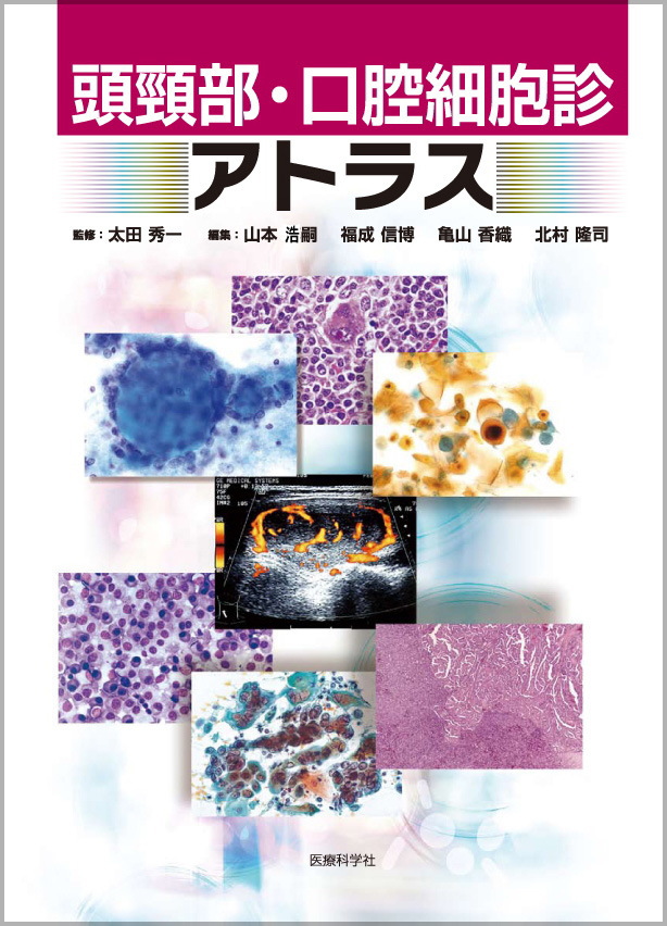 ふろあー」 細胞診 鑑別 アトラス 細胞診鑑別アトラス／医歯薬出版株式会社