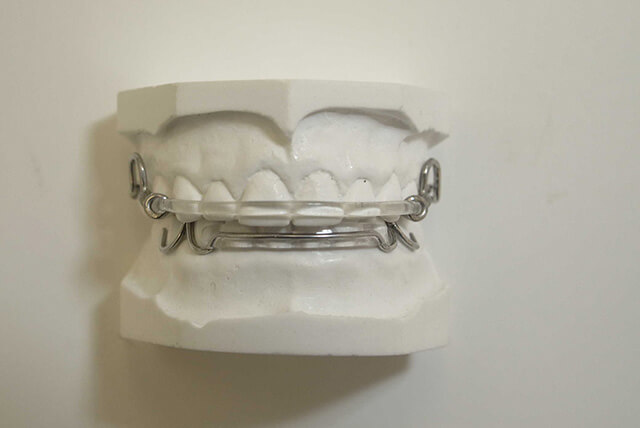 インビザライン取扱説明書｜【公式】池袋駅徒歩1分の矯正歯科・信頼の