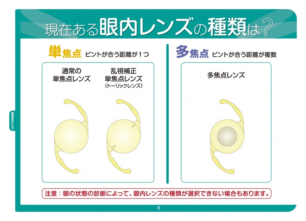 白内障の手術について（多焦点眼内レンズの紹介）｜社会医療法人 慶明