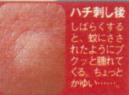 蜂針の健康療法 - 特定非営利活動法人 日本アピセラピー協会へようこそ