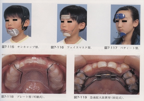 仙台 矯正歯科 歯列矯正 堀歯科医院