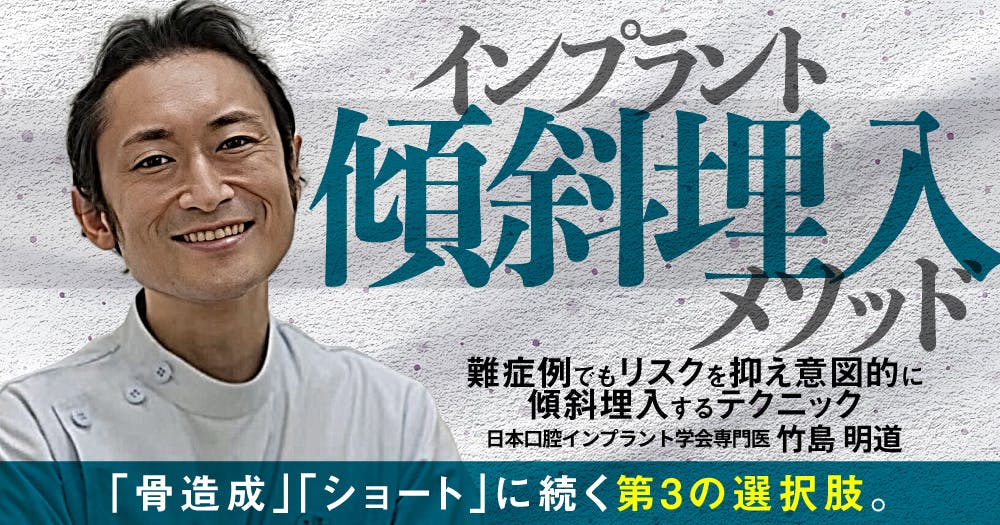 世界の常識「即時治療」を身につける｜歯科オンラインセミナー・録画