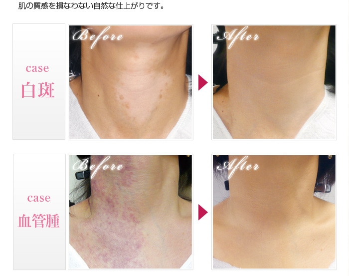 楽天市場】【マーシュフィールド公式】 SC ボディカバーファンデB (7g