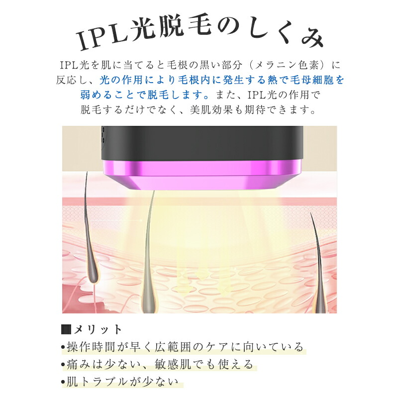 自宅脱毛お試し価格♪】パルス光 IPL美容器 脱毛ケアしやすい