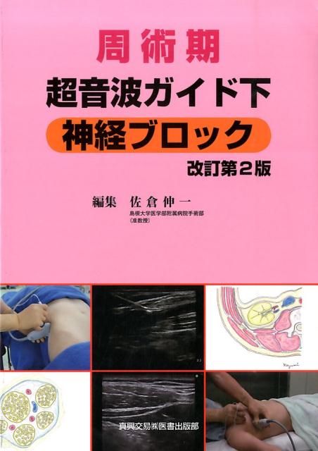 楽天ブックス: 周術期超音波ガイド下神経ブロック 改訂第2版 - 佐倉
