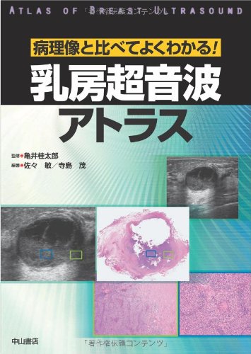 楽天市場】心臓超音波診断アトラス 小児胎児の通販
