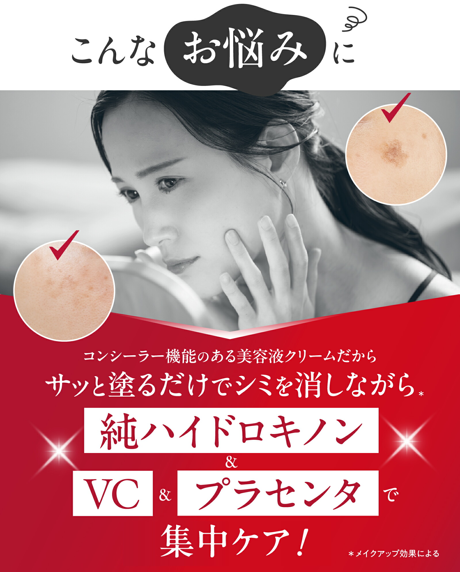 楽天市場】【累計45万個 シミのスピードWケアセット】シミキールパック