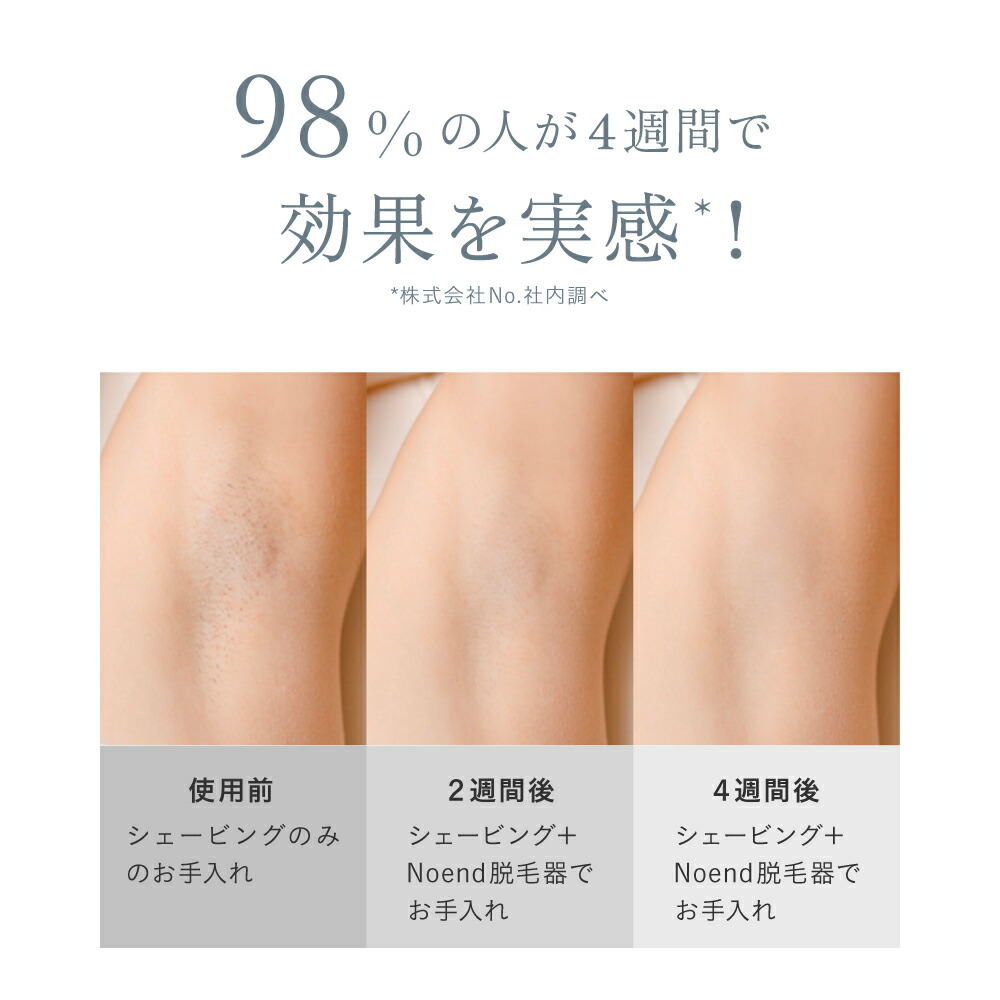 楽天市場】＼楽天ランキング1位！／ Noend コードレス脱毛器 VIO対応