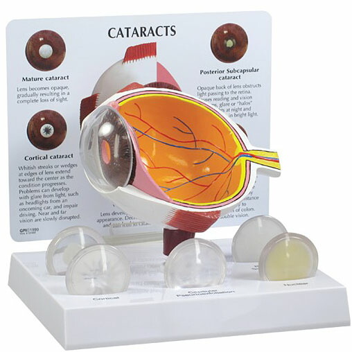 楽天市場】人体模型 眼球 白内障 モデル OM-GP-2800 GPI Anatomicals