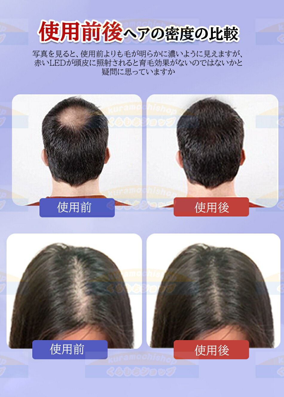 楽天市場】薄毛対策LED赤色光育毛ヘルメット育毛キャップ スカルプケア