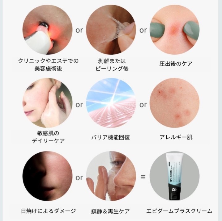 楽天市場】国内正規品 EPIDERM PLUS CREAM エピダーム プラス クリーム