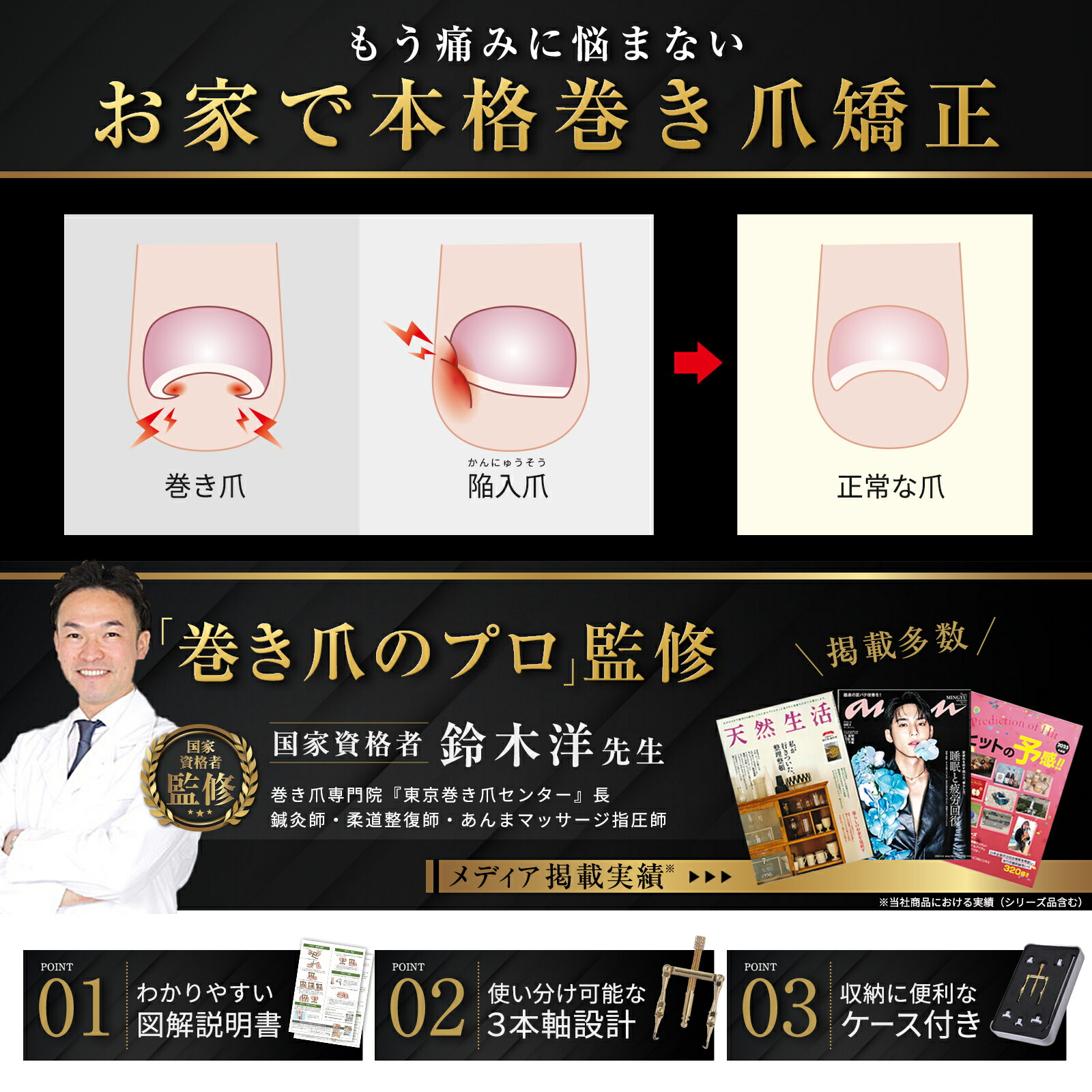 楽天市場】【SALE：7,480円→4,970円！】 巻き爪クイット 巻き爪