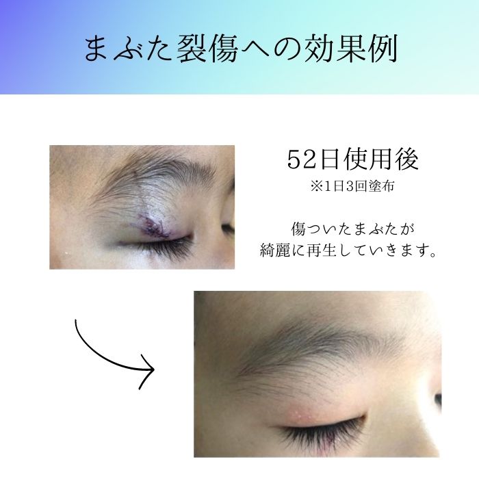 楽天市場】【正規代理店】シルバースペース+ 80g SILVER SPACE+ 痛み