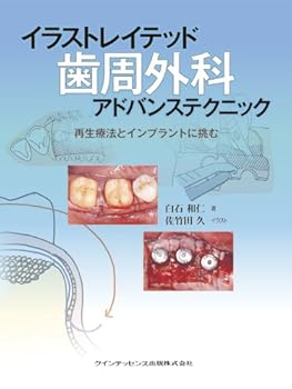 楽天市場】イラストレイテッド歯冠修復アドバンステクニックの通販