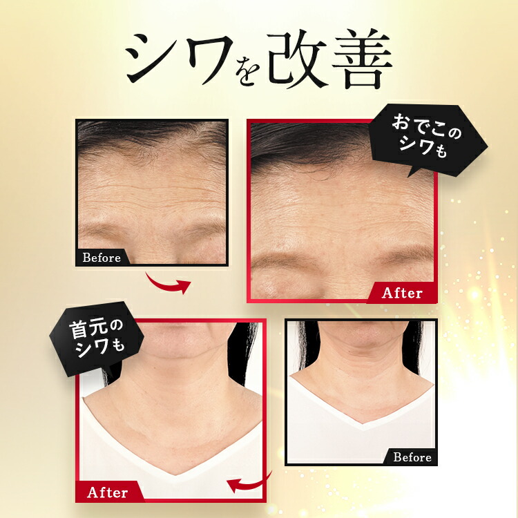 楽天市場】【公式】【つめかえ用パウチ】パーフェクトワン 薬用