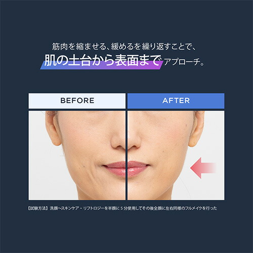 楽天市場】【P5倍☆3/4 20:00から3/11 1:59まで】美顔器【ヤーマン公式