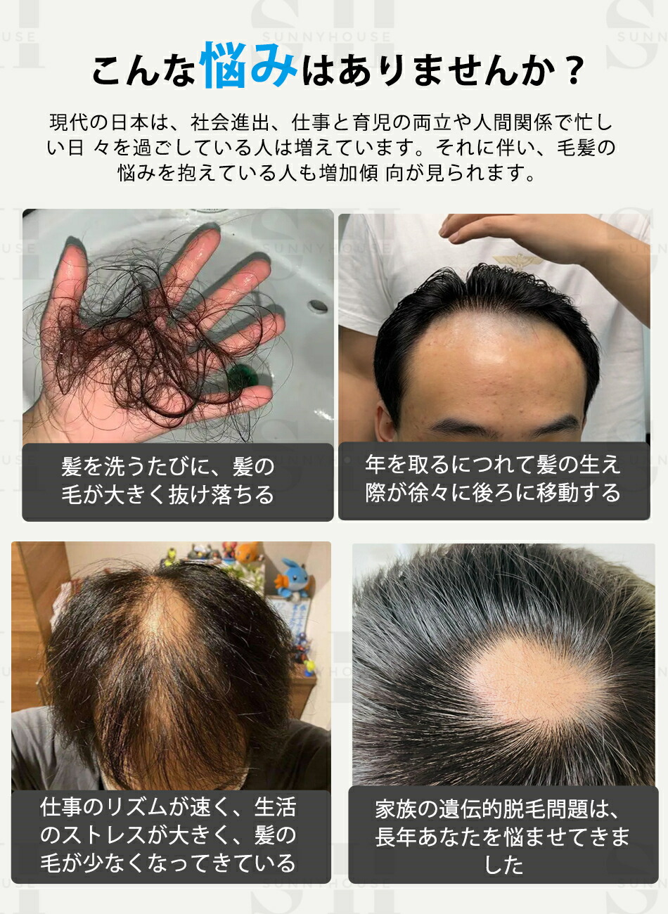 楽天市場】育毛キャップ 赤色LED 育毛システム 110個led 育毛赤色光