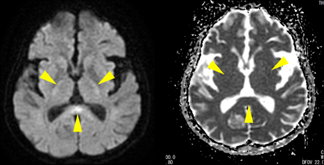 症例8：診断と解説