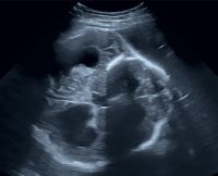 所見から探る産科超音波診断