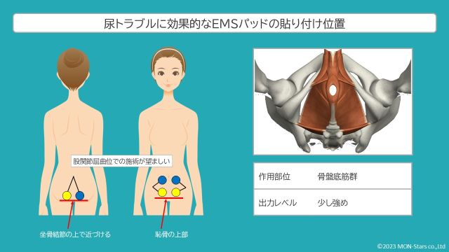 骨盤底筋が衰える原因とは【EMSで効率的に骨盤底筋トレーニング