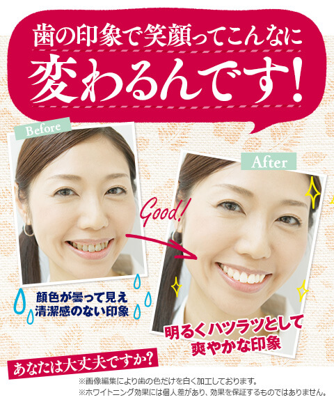 ちゅらトゥース