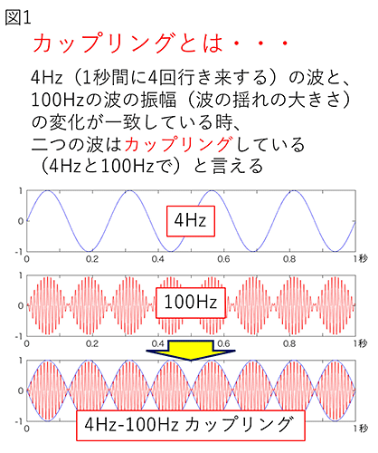 てんかん発作時の特徴的な脳波を世界で初めて検出―病態解明や診断精度