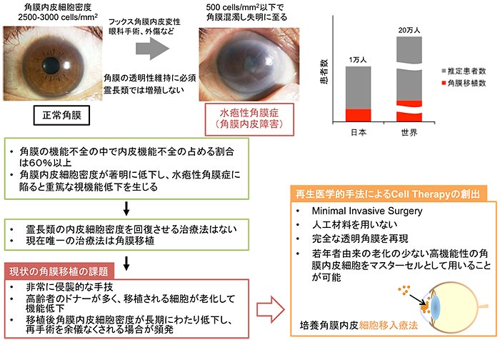 水疱性角膜症に対する培養ヒト角膜内皮細胞移植の医師主導治験を開始