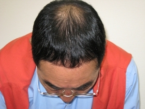 植物性増毛パウダー Tip Top - 株式会社エイアールティ