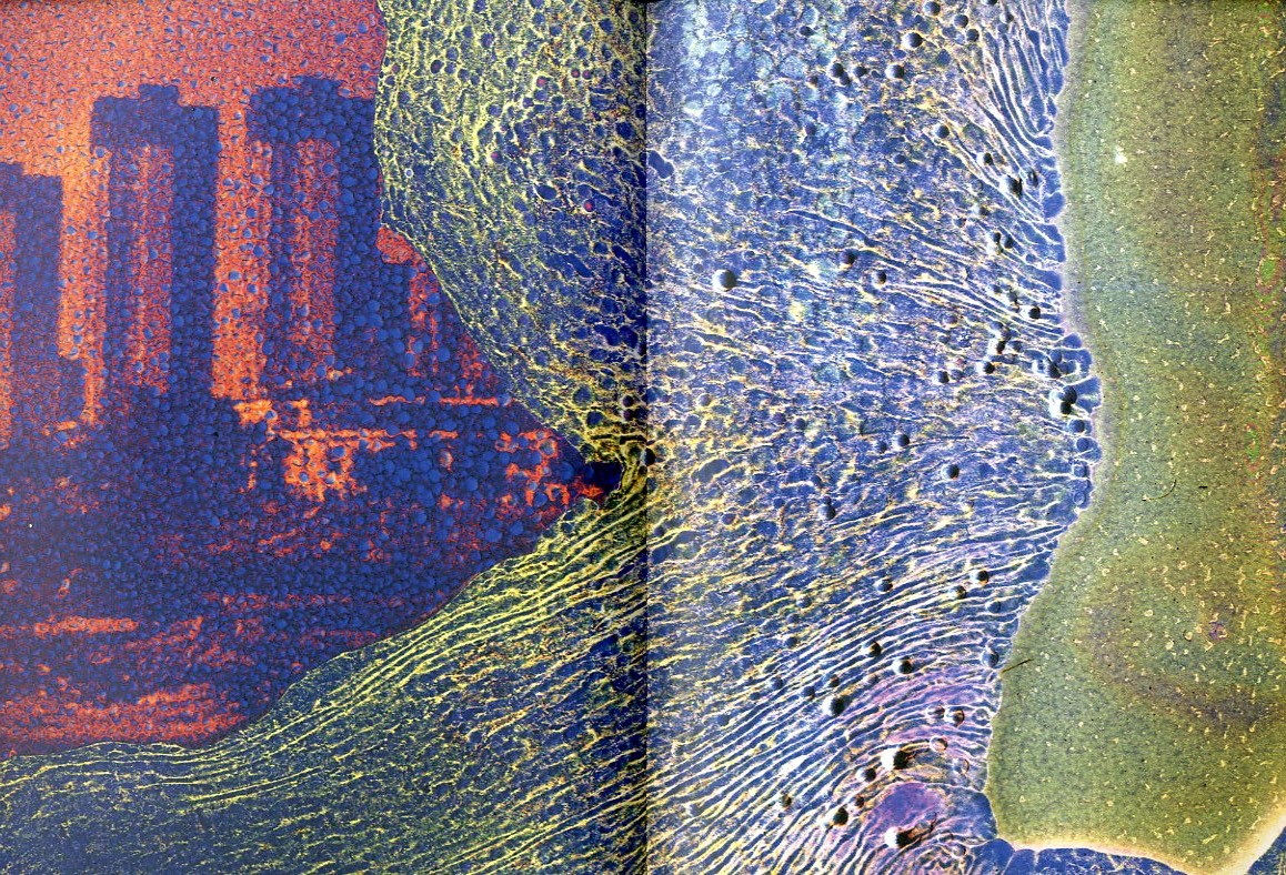 MATTER / BURN OUT / 横田大輔 | 小宮山書店 KOMIYAMA TOKYO | 神保町