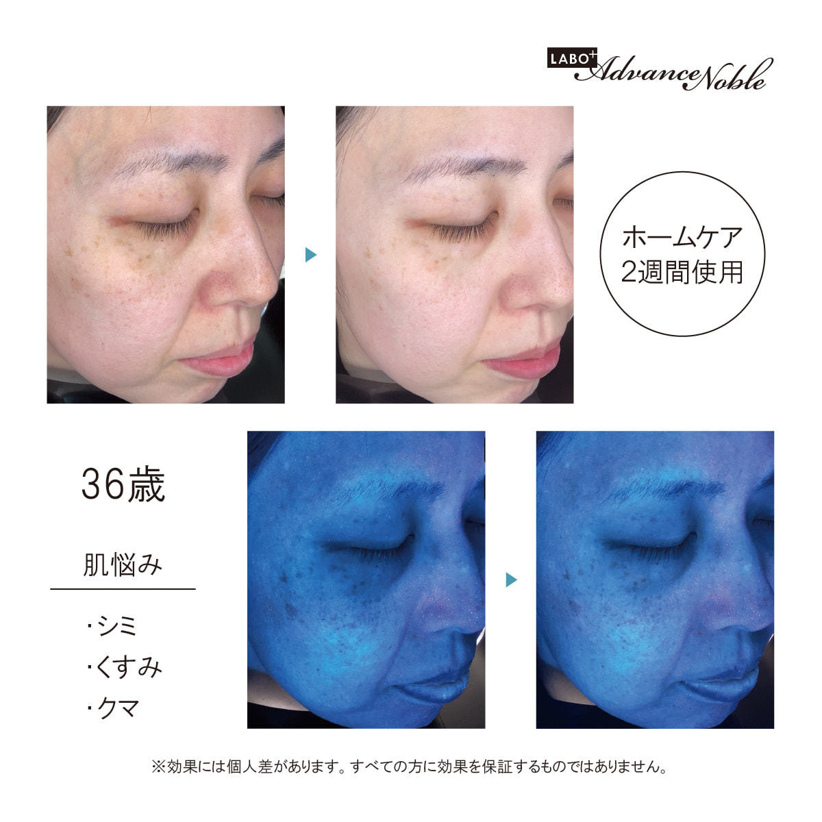 ラボプラス ADノーブル ニューエラ ブライトセラム 30ml【店販用】の卸