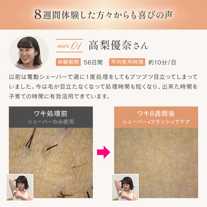 ステラボーテ IPL光美容器 Luna ディノスANAmall店