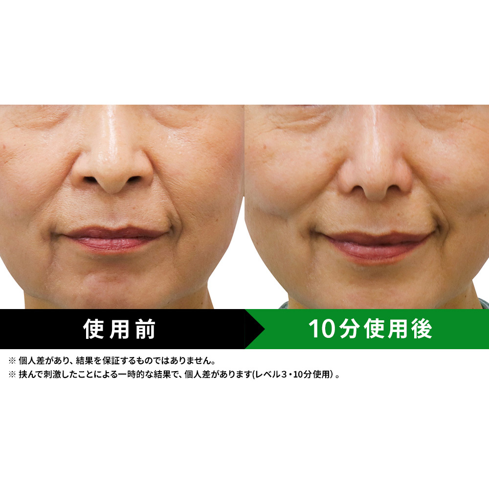 ルクセア フォーネス PRO（鼻用美顔器）/LUXCEAR Fornez PRO ディノス