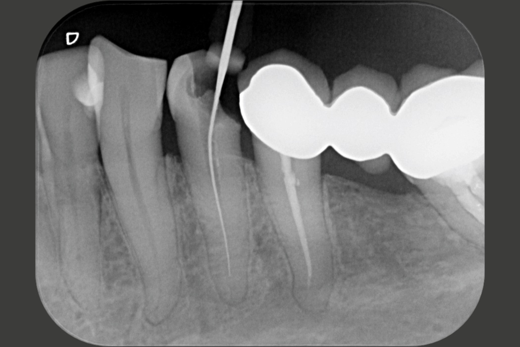 Dürr Dental｜VistaScan Mini View 2.0 IPスキャナー