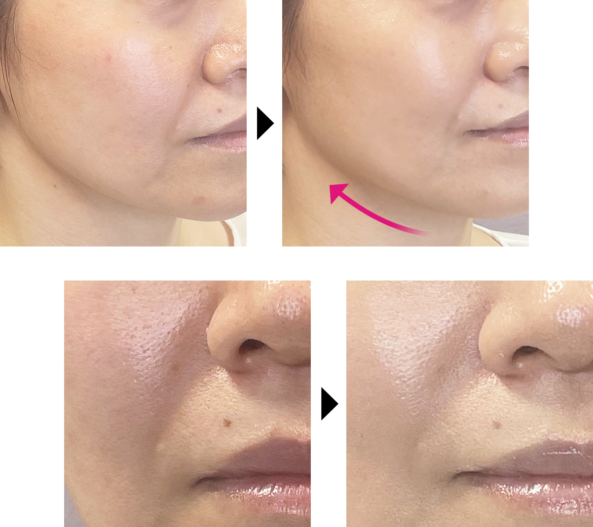 こな ドクターソワ5点セット ドクターソワ 5点セット 【公式通販】