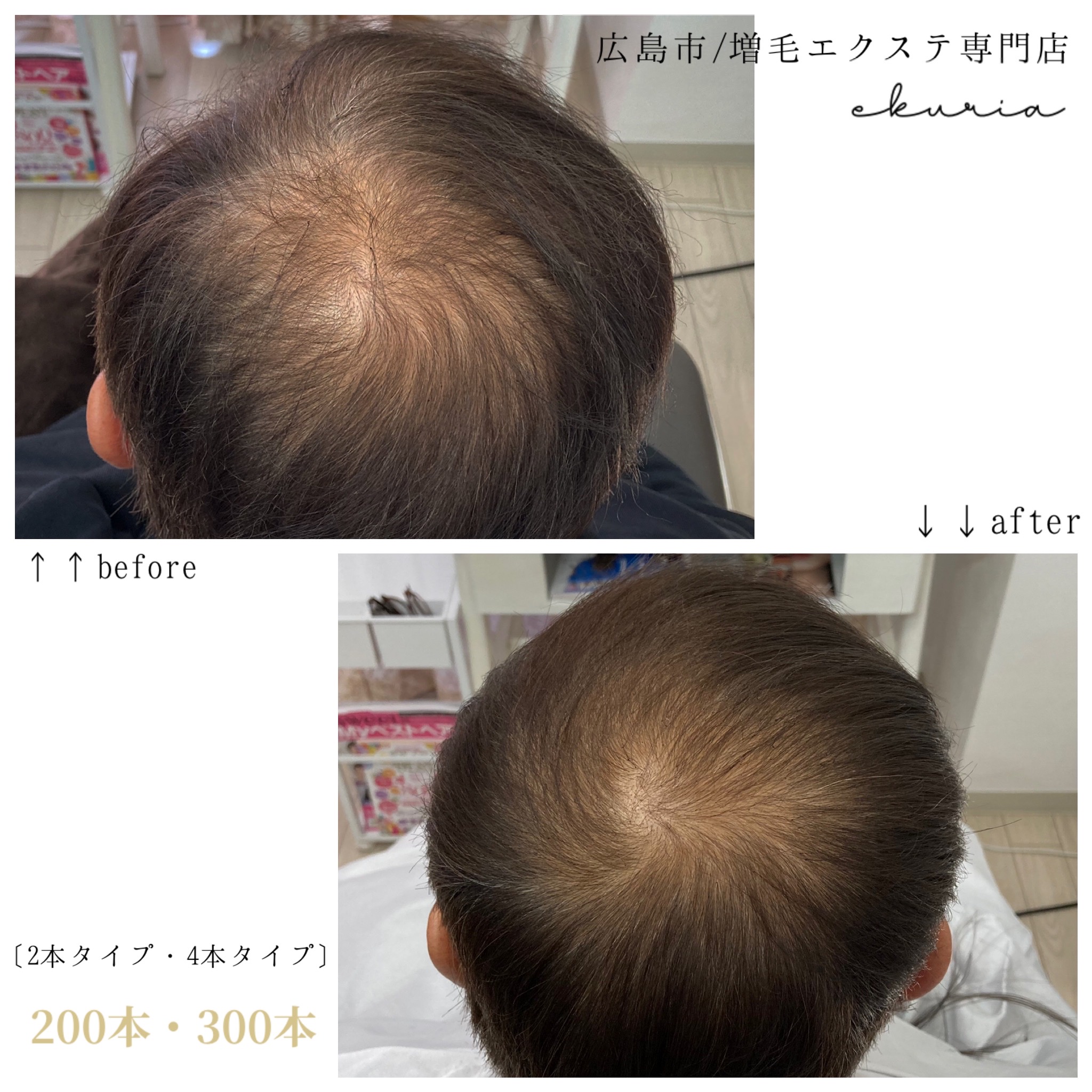 増毛エクステ Before After