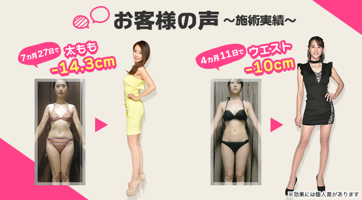 エステ・痩身・フェイシャル・脱毛のエルセーヌ