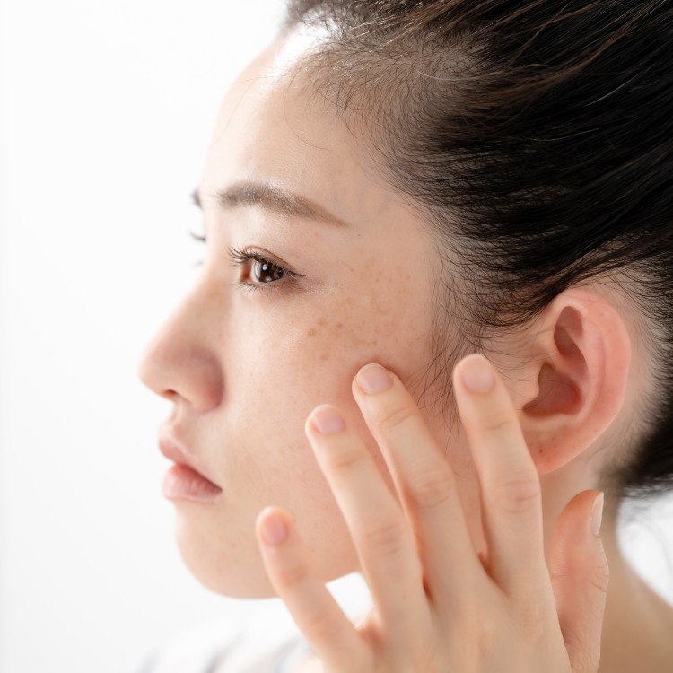 そばかすとシミの違いとは？見分け方や対策、ケアの方法を解説