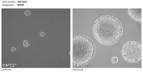 ATCC®の神経細胞株 | ATCC® Neural Cell Lines | フナコシ