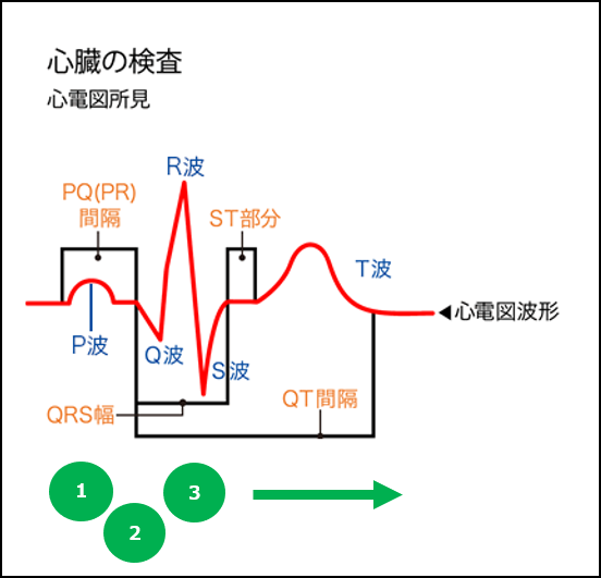 心電図、ホンキのキホン1 心電図って何を表しているの？ | 心電図