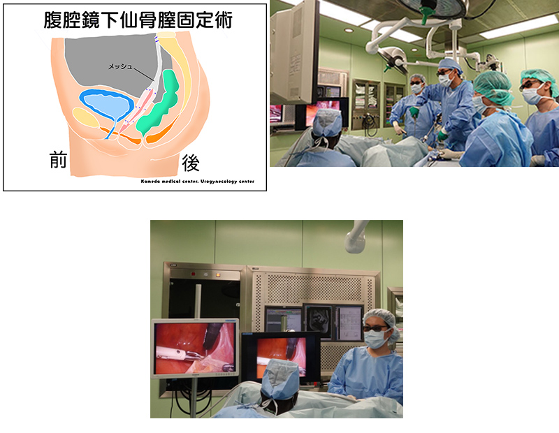 手術について | 亀田メディカルセンター ウロギネ・女性排尿機能センター