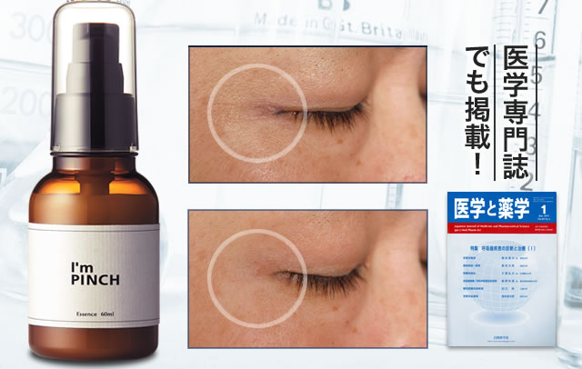 高濃・高浸透のI'm PINCH今すぐ申込みます｜乾燥からピンチな肌を救う