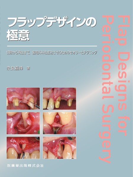 超音波”を攻略せよ ペリオドンタル・デブライドメント プラス1／医歯薬