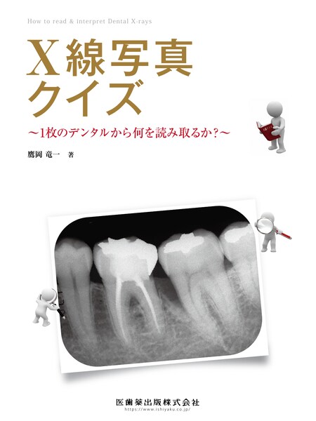歯科臨床における画像診断アトラス／医歯薬出版株式会社